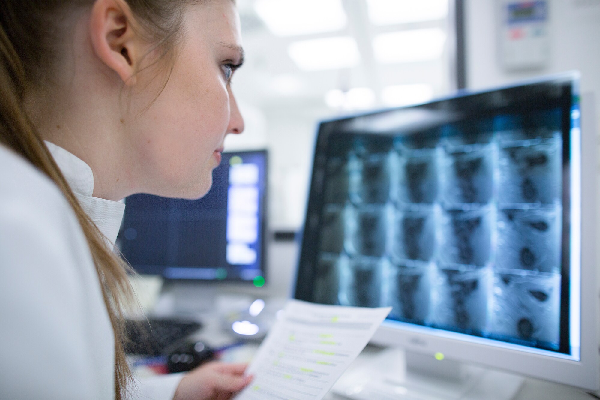 Radiolodzy stają się kluczowymi specjalistami ds. danych w medycynie