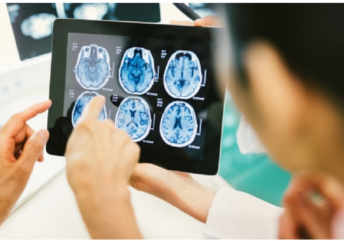 Nowa sekwencja obrazowania mózgu w rezonansie magnetycznym dwukrotnie poprawia widoczność guzów mózgu